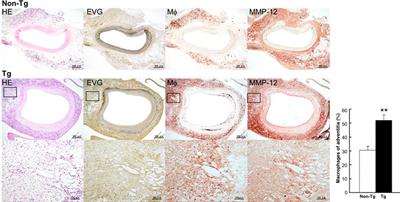 Macrophage elastase derived from adventitial macrophages modulates aortic remodeling